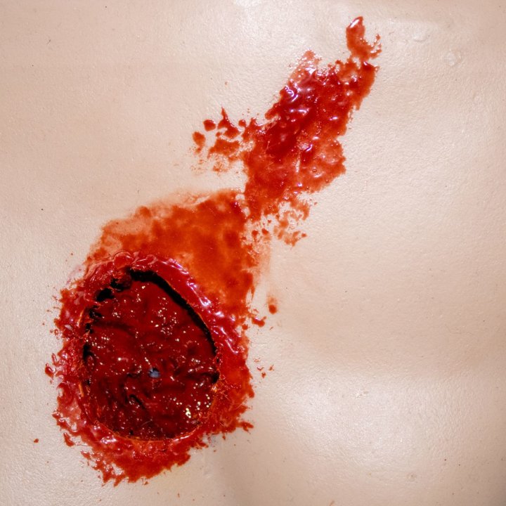 Simulator zur Kontrolle von Blutungen