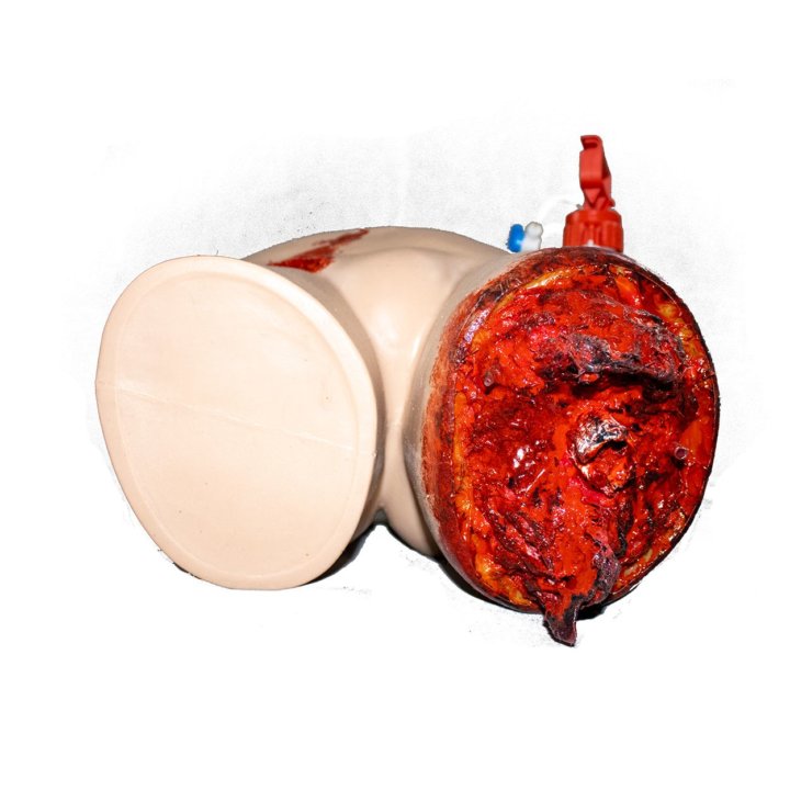 Simulator zur Kontrolle von Blutungen