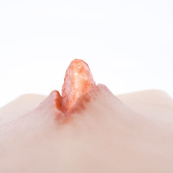 Zu tragende Wunden - offener Schienbeinbruch, Unterschenkel