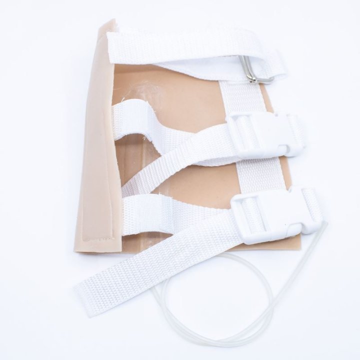 Plaies à porter - fracture ouverte du tibia, jambe inférieure avec écoulement