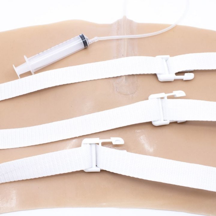 Zu tragende Wunden - offener Oberschenkelbruch, oberes Bein mit Ausfluss