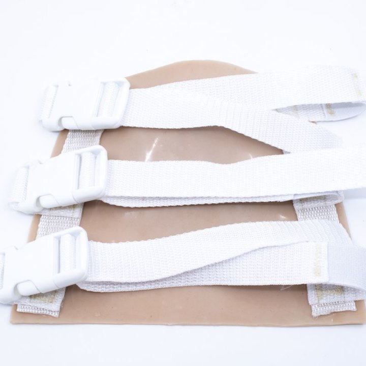 Zu tragende Wunden - offener Bruch des Oberarms, Oberarm