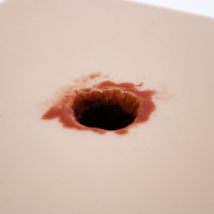 Simulator für das Packen von Wunden, grundlegende Quadratkugelverletzung