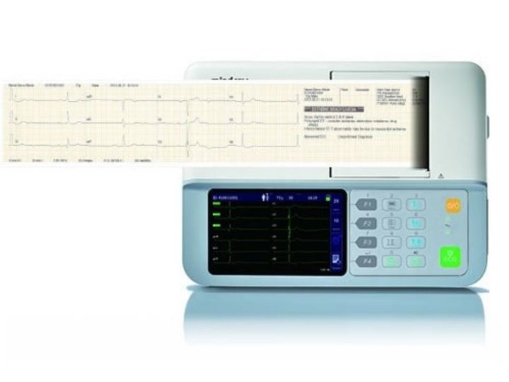 Mindray BeneHeart R3 12-Kanal-EKG