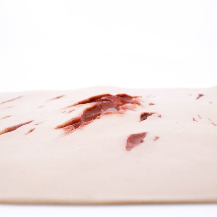 Wunden zum Tragen - schwere Risswunden, oberes Bein