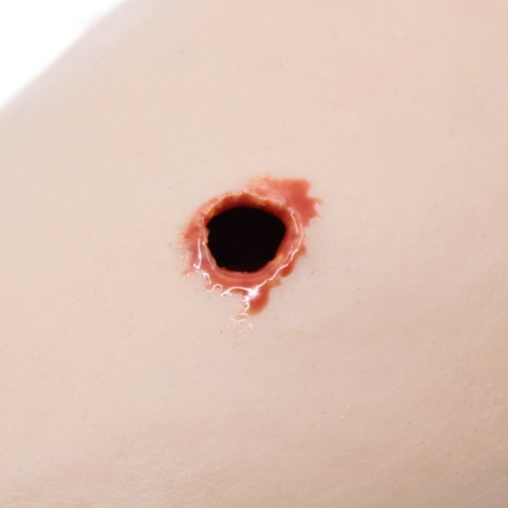 Simulator für Wundpackung, Schusswunde