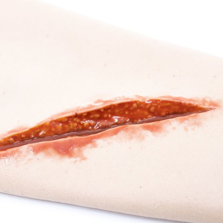 Zu tragende Wunden - starke Risswunde am Unterarm