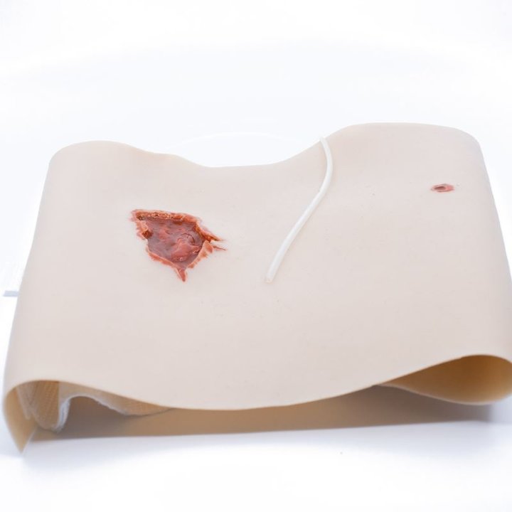 Wunden zum Tragen - Schusswunde Ein-/Austritt, Oberschenkel mit Ausfluss