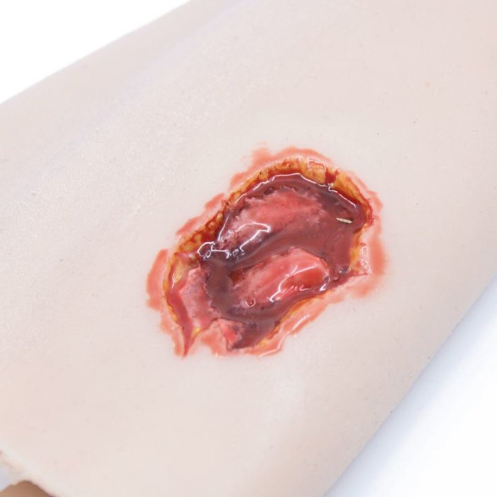 Ferite da indossare - Ferita d'arma da fuoco d'ingresso/uscita sull'avambraccio con scarico