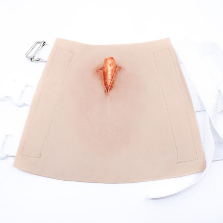 Zu tragende Wunden - offener Schienbeinbruch, Unterschenkel